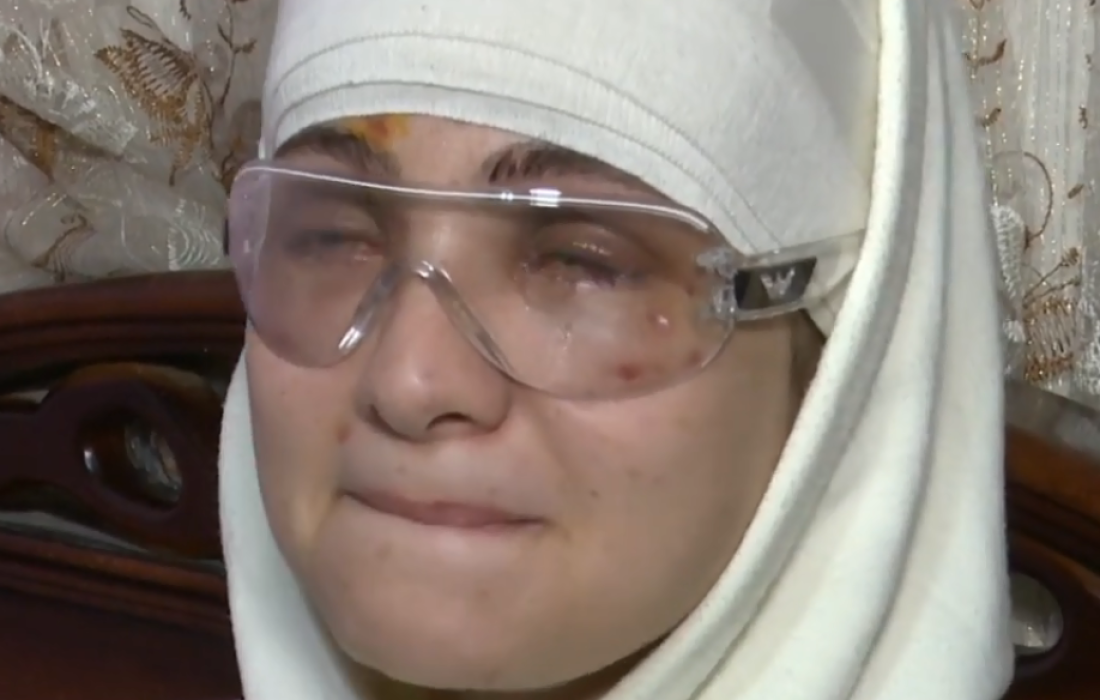 ما قصة البلوجر سارة محمد التي فقدت بصرها- القصة كاملة لإصابة البلوجر سرة محمد بالعمى